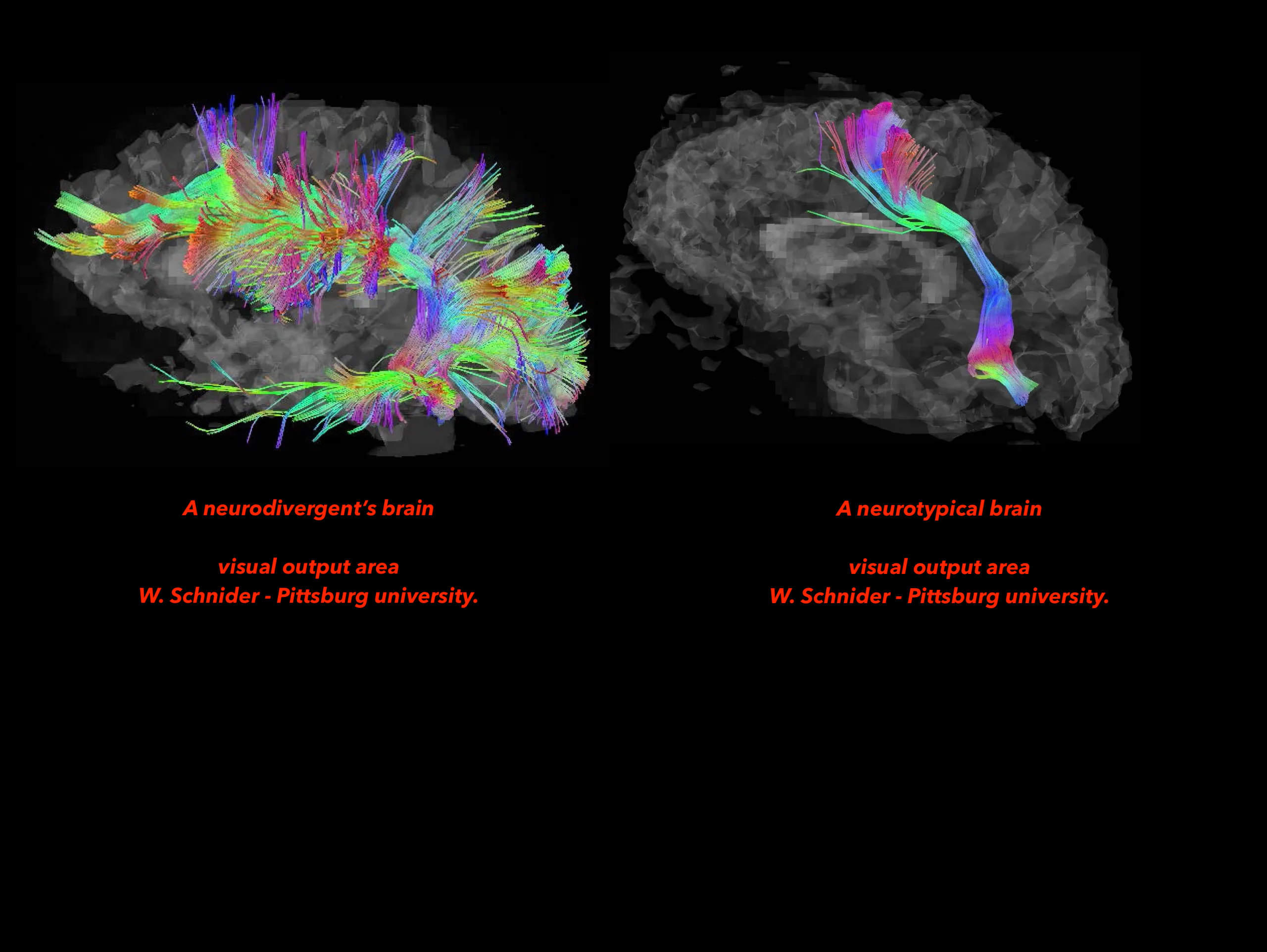 brain scan of ND & NT brians - the neurodivergent brain to the left shows more neurones in the visual output. To the right hand side is a neurotypical brain's visual output - much smaller.